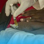 ‎Afrique : le Kenya lance le lénacapavir, une injection préventive deux fois par an pour lutter contre le VIH